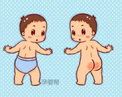 夏天穿纸尿裤真的会红屁股吗？