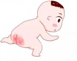 春天穿纸尿裤容易出现红屁屁，4招教你轻松搞定！