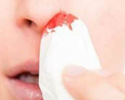 流鼻血的时候，别再傻傻地用卫生纸堵鼻子了！